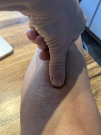 Localisation du point d’acupuncture E36 sur la jambe, utilisé pour soutenir la digestion et l’équilibre du poids