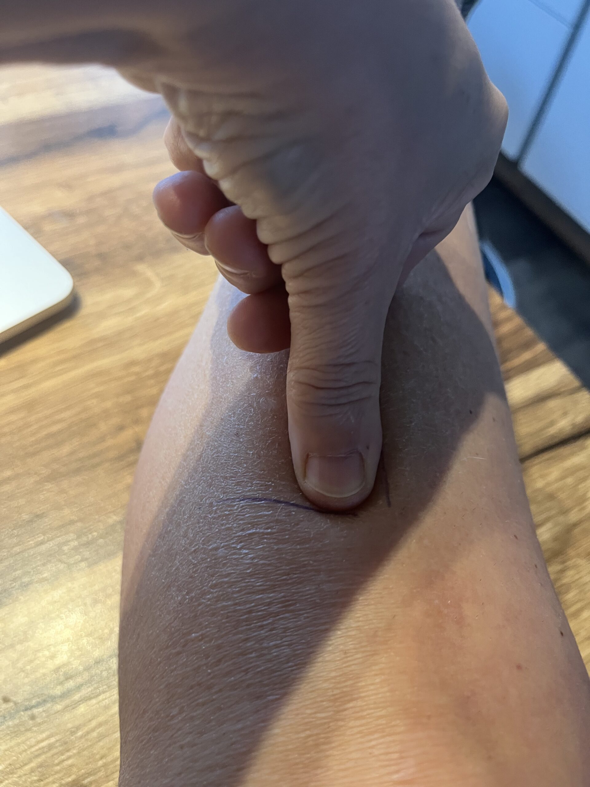 Localisation du point d’acupuncture E36 sur la jambe, utilisé pour soutenir la digestion et l’équilibre du poids